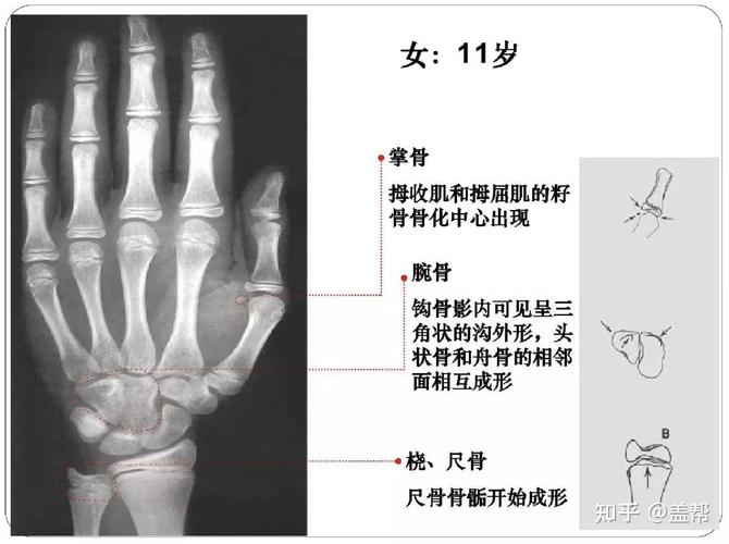 儿童是几岁到几岁_几岁到几岁属于儿童阶段